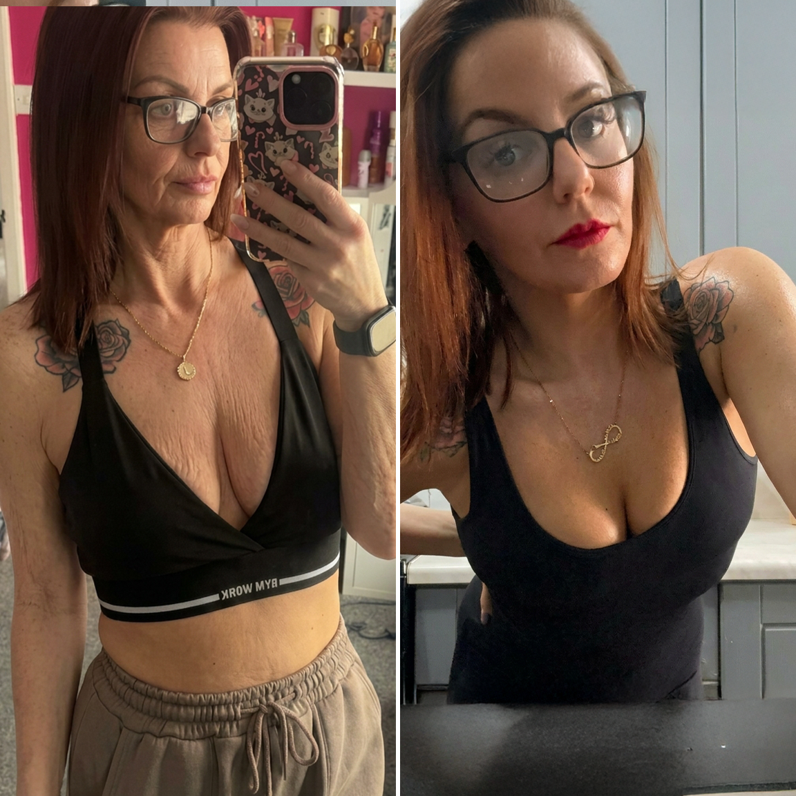 💯HISKIN® Mikroneedlová náplast pro podporu objemu, lifting a pevnost prsou