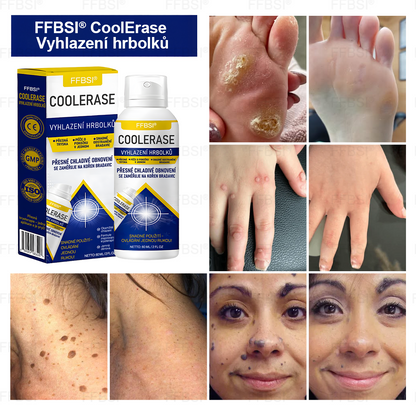 FFBSI® CoolErase Sprej pro regeneraci pokožky (Bradavice, Puchýře, Ekzém, Lupy, Kožní keratózy, Akné, Kožní výrůstky, Jizvy, Mateřská znaménka)