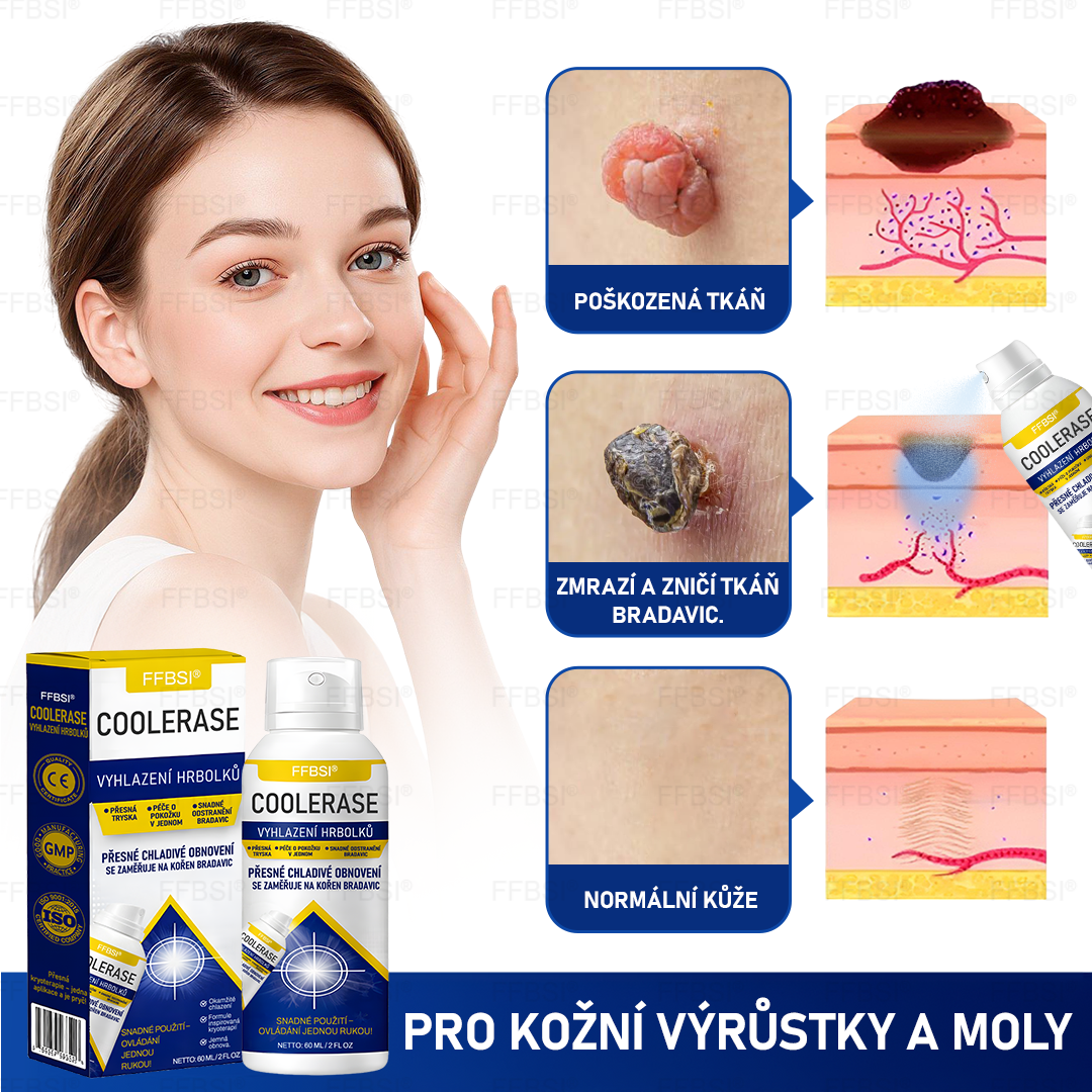 FFBSI® CoolErase Sprej pro regeneraci pokožky (Bradavice, Puchýře, Ekzém, Lupy, Kožní keratózy, Akné, Kožní výrůstky, Jizvy, Mateřská znaménka)