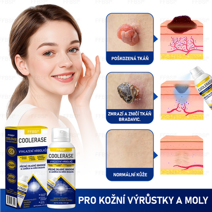 FFBSI® CoolErase Sprej pro regeneraci pokožky (Bradavice, Puchýře, Ekzém, Lupy, Kožní keratózy, Akné, Kožní výrůstky, Jizvy, Mateřská znaménka)