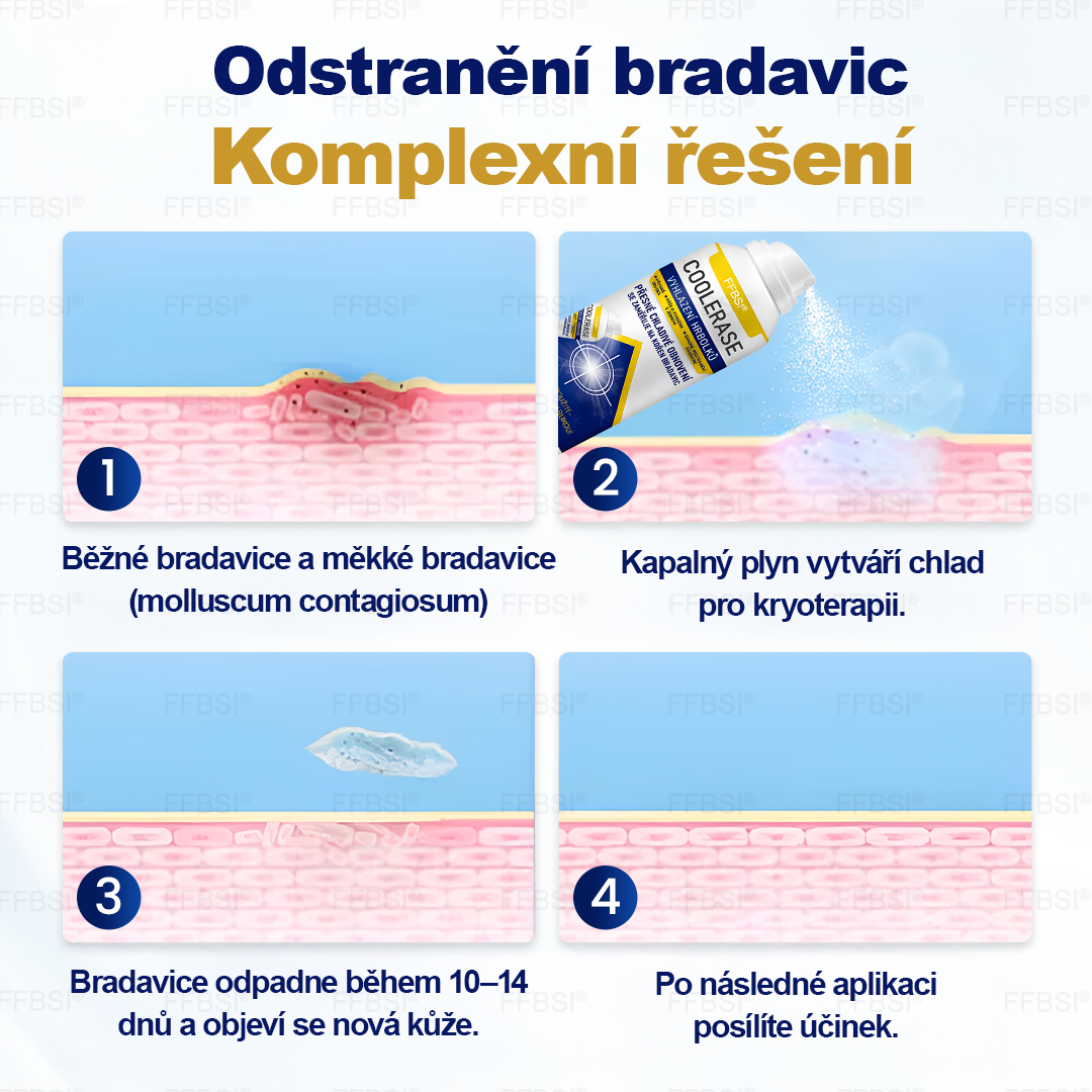 FFBSI® CoolErase Sprej pro regeneraci pokožky (Bradavice, Puchýře, Ekzém, Lupy, Kožní keratózy, Akné, Kožní výrůstky, Jizvy, Mateřská znaménka)