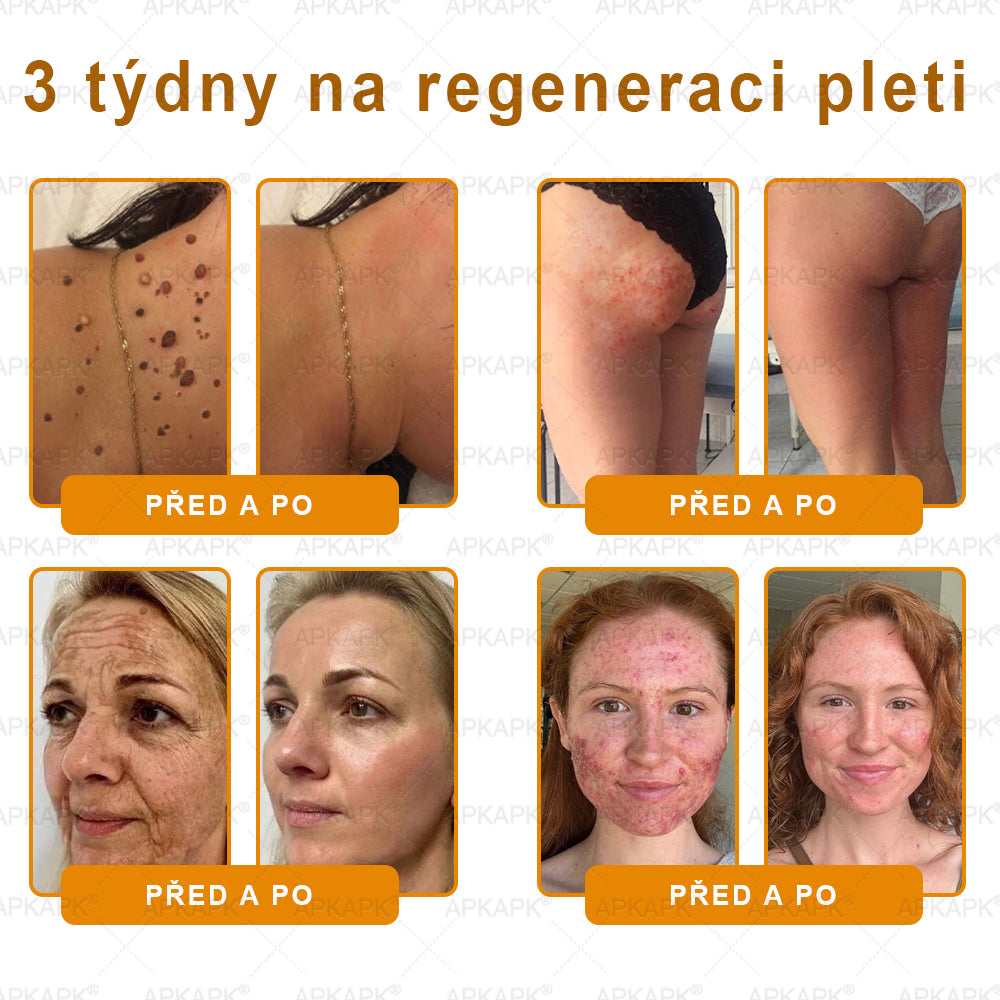 𝖠𝖯𝖪𝖠𝖯𝖪® 🐝~❤️ Krém s včelím jedem na obnovu pokožky 🐝 pomáhá při řešení kožních problémů, jako jsou: vrásky, jizvy, pigmentové skvrny, strie, akné, lupénka, ekzém, kožní léze, podráždění, záněty a další kožní potíže.