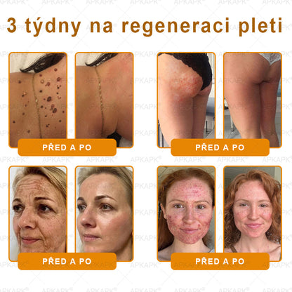 𝖠𝖯𝖪𝖠𝖯𝖪® 🐝~❤️ Krém s včelím jedem na obnovu pokožky 🐝 pomáhá při řešení kožních problémů, jako jsou: vrásky, jizvy, pigmentové skvrny, strie, akné, lupénka, ekzém, kožní léze, podráždění, záněty a další kožní potíže.