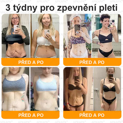 𝖠𝖯𝖪𝖠𝖯𝖪® 🐝~❤️ Krém s včelím jedem na obnovu pokožky 🐝 pomáhá při řešení kožních problémů, jako jsou: vrásky, jizvy, pigmentové skvrny, strie, akné, lupénka, ekzém, kožní léze, podráždění, záněty a další kožní potíže.