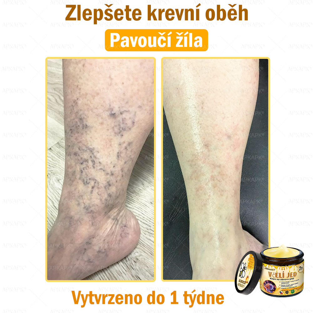 Dermatologicky a klinicky testováno👩‍⚕️🎁APKAPK®Bee Venom Krém na obnovení pleti🐝 pomáhá při léčbě kožních problémů, jako jsou: vrásky, jizvy, pigmentové skvrny, strie, akné, psoriáza, ekzém, kožní změny, podráždění, záněty a další kožní problémy.