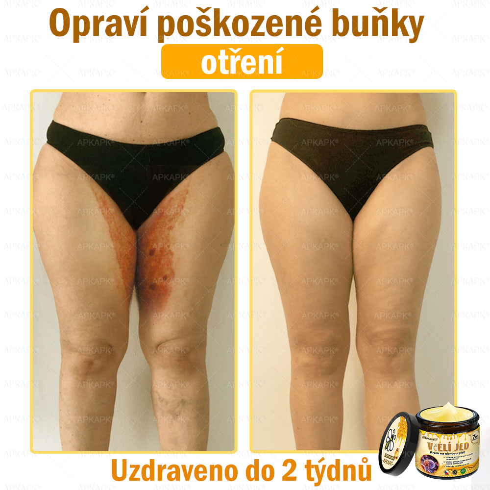 Dermatologicky a klinicky testováno👩‍⚕️🎁APKAPK®Bee Venom Krém na obnovení pleti🐝 pomáhá při léčbě kožních problémů, jako jsou: vrásky, jizvy, pigmentové skvrny, strie, akné, psoriáza, ekzém, kožní změny, podráždění, záněty a další kožní problémy.