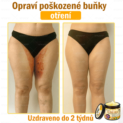 Dermatologicky a klinicky testováno👩‍⚕️🎁APKAPK®Bee Venom Krém na obnovení pleti🐝 pomáhá při léčbě kožních problémů, jako jsou: vrásky, jizvy, pigmentové skvrny, strie, akné, psoriáza, ekzém, kožní změny, podráždění, záněty a další kožní problémy.