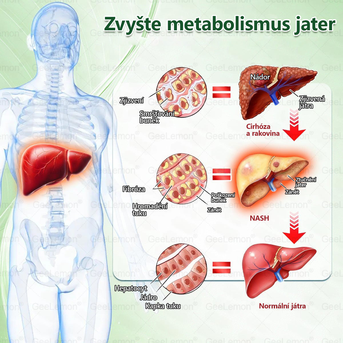 Oficiální český obchod~💥🫶𝐆𝐞𝐞𝐋𝐞𝐦𝐨𝐧® 10v1 Nanomikrojehlicové náplasti na formování těla 🇨🇿 Pouze 1 použití denně ✅ Výsledky viditelné již za 7 dní – vhodné pro obezitu, kardiovaskulární zdraví, cukrovku a problémy s klouby