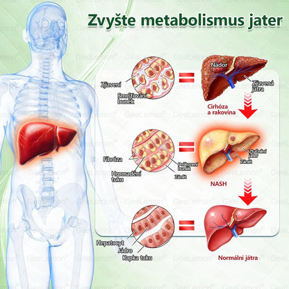 Oficiální český obchod~💥🫶𝐆𝐞𝐞𝐋𝐞𝐦𝐨𝐧® 10v1 Nanomikrojehlicové náplasti na formování těla 🇨🇿 Pouze 1 použití denně ✅ Výsledky viditelné již za 7 dní – vhodné pro obezitu, kardiovaskulární zdraví, cukrovku a problémy s klouby