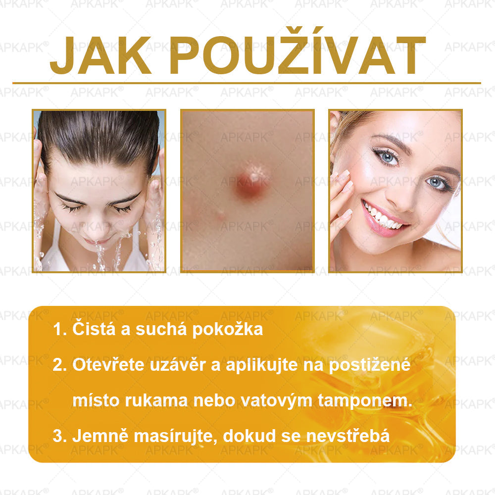 𝖠𝖯𝖪𝖠𝖯𝖪® 🐝~❤️ Krém s včelím jedem na obnovu pokožky 🐝 pomáhá při řešení kožních problémů, jako jsou: vrásky, jizvy, pigmentové skvrny, strie, akné, lupénka, ekzém, kožní léze, podráždění, záněty a další kožní potíže.