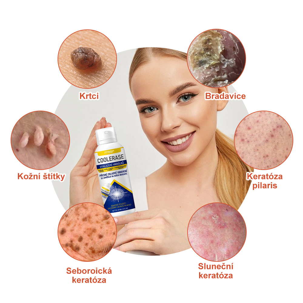 FFBSI® CoolErase Sprej pro regeneraci pokožky (Bradavice, Puchýře, Ekzém, Lupy, Kožní keratózy, Akné, Kožní výrůstky, Jizvy, Mateřská znaménka)