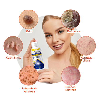 FFBSI® CoolErase Sprej pro regeneraci pokožky (Bradavice, Puchýře, Ekzém, Lupy, Kožní keratózy, Akné, Kožní výrůstky, Jizvy, Mateřská znaménka)