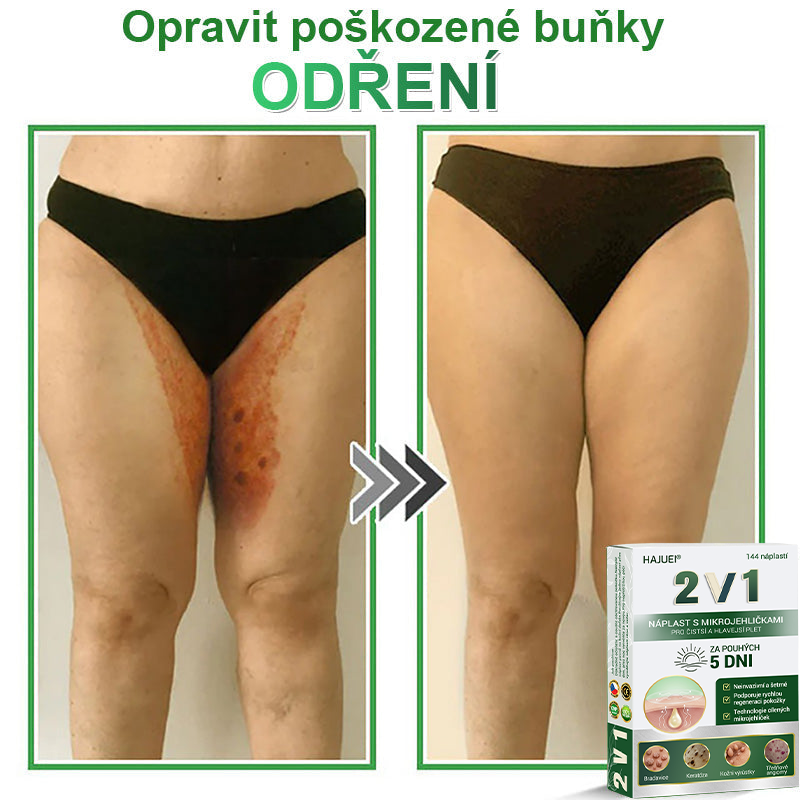 HAJUEI® 💖 𝟐𝐯𝟏 𝐡𝐲𝐝𝐫𝐨𝐤𝐨𝐥𝐨𝐢𝐝𝐧í 𝐧á𝐩𝐥𝐚𝐬𝐭𝐢 𝐬 𝐦𝐢𝐤𝐫𝐨𝐣𝐞𝐡𝐥𝐢č𝐤𝐚𝐦𝐢 | 𝐒𝐩𝐞𝐜𝐢á𝐥𝐧ě 𝐯𝐲𝐯𝐢𝐧𝐮𝐭é 𝐩𝐫𝐨 𝐨𝐝𝐬𝐭𝐫𝐚𝐧ě𝐧í 𝐯𝐲𝐬𝐭𝐨𝐮𝐩𝐥ý𝐜𝐡 𝐦𝐚𝐭𝐞ř𝐬𝐤ý𝐜𝐡 𝐳𝐧𝐚𝐦é𝐧𝐞𝐤, 𝐚𝐤𝐧é, 𝐩𝐥𝐨𝐜𝐡ý𝐜𝐡 𝐛𝐫𝐚𝐝𝐚𝐯𝐢𝐜 𝐚 𝐤𝐨ž𝐧í𝐜𝐡 𝐯ý𝐫ů𝐬𝐭𝐤ů | 𝐁𝐚𝐥𝐞𝐧í 𝟏𝟒𝟒 𝐤𝐮𝐬ů🌵🌵