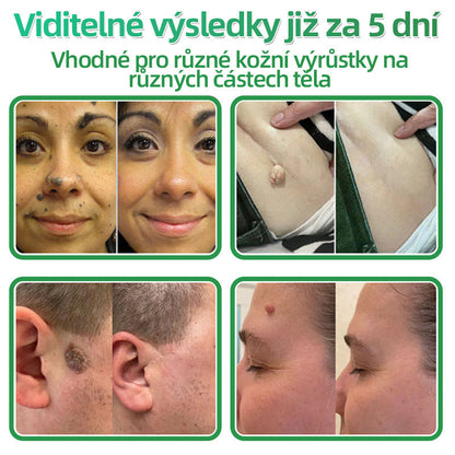 HAJUEI® 💖 𝟐𝐯𝟏 𝐡𝐲𝐝𝐫𝐨𝐤𝐨𝐥𝐨𝐢𝐝𝐧í 𝐧á𝐩𝐥𝐚𝐬𝐭𝐢 𝐬 𝐦𝐢𝐤𝐫𝐨𝐣𝐞𝐡𝐥𝐢č𝐤𝐚𝐦𝐢 | 𝐒𝐩𝐞𝐜𝐢á𝐥𝐧ě 𝐯𝐲𝐯𝐢𝐧𝐮𝐭é 𝐩𝐫𝐨 𝐨𝐝𝐬𝐭𝐫𝐚𝐧ě𝐧í 𝐯𝐲𝐬𝐭𝐨𝐮𝐩𝐥ý𝐜𝐡 𝐦𝐚𝐭𝐞ř𝐬𝐤ý𝐜𝐡 𝐳𝐧𝐚𝐦é𝐧𝐞𝐤, 𝐚𝐤𝐧é, 𝐩𝐥𝐨𝐜𝐡ý𝐜𝐡 𝐛𝐫𝐚𝐝𝐚𝐯𝐢𝐜 𝐚 𝐤𝐨ž𝐧í𝐜𝐡 𝐯ý𝐫ů𝐬𝐭𝐤ů | 𝐁𝐚𝐥𝐞𝐧í 𝟏𝟒𝟒 𝐤𝐮𝐬ů🌵🌵