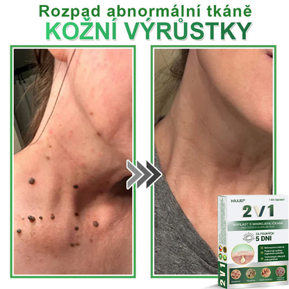 HAJUEI® 💖 𝟐𝐯𝟏 𝐡𝐲𝐝𝐫𝐨𝐤𝐨𝐥𝐨𝐢𝐝𝐧í 𝐧á𝐩𝐥𝐚𝐬𝐭𝐢 𝐬 𝐦𝐢𝐤𝐫𝐨𝐣𝐞𝐡𝐥𝐢č𝐤𝐚𝐦𝐢 | 𝐒𝐩𝐞𝐜𝐢á𝐥𝐧ě 𝐯𝐲𝐯𝐢𝐧𝐮𝐭é 𝐩𝐫𝐨 𝐨𝐝𝐬𝐭𝐫𝐚𝐧ě𝐧í 𝐯𝐲𝐬𝐭𝐨𝐮𝐩𝐥ý𝐜𝐡 𝐦𝐚𝐭𝐞ř𝐬𝐤ý𝐜𝐡 𝐳𝐧𝐚𝐦é𝐧𝐞𝐤, 𝐚𝐤𝐧é, 𝐩𝐥𝐨𝐜𝐡ý𝐜𝐡 𝐛𝐫𝐚𝐝𝐚𝐯𝐢𝐜 𝐚 𝐤𝐨ž𝐧í𝐜𝐡 𝐯ý𝐫ů𝐬𝐭𝐤ů | 𝐁𝐚𝐥𝐞𝐧í 𝟏𝟒𝟒 𝐤𝐮𝐬ů🌵🌵