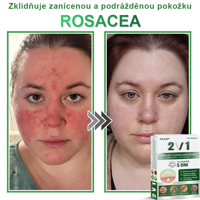 HAJUEI® 💖 𝟐𝐯𝟏 𝐡𝐲𝐝𝐫𝐨𝐤𝐨𝐥𝐨𝐢𝐝𝐧í 𝐧á𝐩𝐥𝐚𝐬𝐭𝐢 𝐬 𝐦𝐢𝐤𝐫𝐨𝐣𝐞𝐡𝐥𝐢č𝐤𝐚𝐦𝐢 | 𝐒𝐩𝐞𝐜𝐢á𝐥𝐧ě 𝐯𝐲𝐯𝐢𝐧𝐮𝐭é 𝐩𝐫𝐨 𝐨𝐝𝐬𝐭𝐫𝐚𝐧ě𝐧í 𝐯𝐲𝐬𝐭𝐨𝐮𝐩𝐥ý𝐜𝐡 𝐦𝐚𝐭𝐞ř𝐬𝐤ý𝐜𝐡 𝐳𝐧𝐚𝐦é𝐧𝐞𝐤, 𝐚𝐤𝐧é, 𝐩𝐥𝐨𝐜𝐡ý𝐜𝐡 𝐛𝐫𝐚𝐝𝐚𝐯𝐢𝐜 𝐚 𝐤𝐨ž𝐧í𝐜𝐡 𝐯ý𝐫ů𝐬𝐭𝐤ů | 𝐁𝐚𝐥𝐞𝐧í 𝟏𝟒𝟒 𝐤𝐮𝐬ů🌵🌵