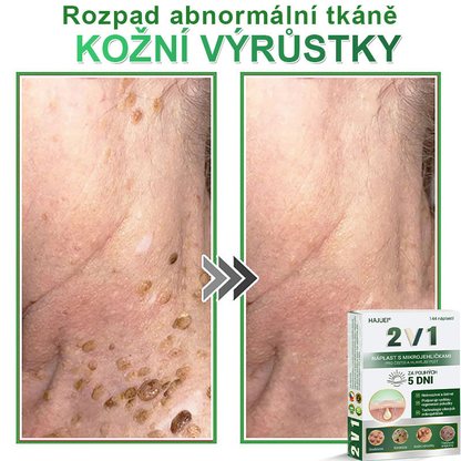 HAJUEI® 💖 𝟐𝐯𝟏 𝐡𝐲𝐝𝐫𝐨𝐤𝐨𝐥𝐨𝐢𝐝𝐧í 𝐧á𝐩𝐥𝐚𝐬𝐭𝐢 𝐬 𝐦𝐢𝐤𝐫𝐨𝐣𝐞𝐡𝐥𝐢č𝐤𝐚𝐦𝐢 | 𝐒𝐩𝐞𝐜𝐢á𝐥𝐧ě 𝐯𝐲𝐯𝐢𝐧𝐮𝐭é 𝐩𝐫𝐨 𝐨𝐝𝐬𝐭𝐫𝐚𝐧ě𝐧í 𝐯𝐲𝐬𝐭𝐨𝐮𝐩𝐥ý𝐜𝐡 𝐦𝐚𝐭𝐞ř𝐬𝐤ý𝐜𝐡 𝐳𝐧𝐚𝐦é𝐧𝐞𝐤, 𝐚𝐤𝐧é, 𝐩𝐥𝐨𝐜𝐡ý𝐜𝐡 𝐛𝐫𝐚𝐝𝐚𝐯𝐢𝐜 𝐚 𝐤𝐨ž𝐧í𝐜𝐡 𝐯ý𝐫ů𝐬𝐭𝐤ů | 𝐁𝐚𝐥𝐞𝐧í 𝟏𝟒𝟒 𝐤𝐮𝐬ů🌵🌵