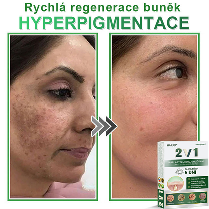 HAJUEI® 💖 𝟐𝐯𝟏 𝐡𝐲𝐝𝐫𝐨𝐤𝐨𝐥𝐨𝐢𝐝𝐧í 𝐧á𝐩𝐥𝐚𝐬𝐭𝐢 𝐬 𝐦𝐢𝐤𝐫𝐨𝐣𝐞𝐡𝐥𝐢č𝐤𝐚𝐦𝐢 | 𝐒𝐩𝐞𝐜𝐢á𝐥𝐧ě 𝐯𝐲𝐯𝐢𝐧𝐮𝐭é 𝐩𝐫𝐨 𝐨𝐝𝐬𝐭𝐫𝐚𝐧ě𝐧í 𝐯𝐲𝐬𝐭𝐨𝐮𝐩𝐥ý𝐜𝐡 𝐦𝐚𝐭𝐞ř𝐬𝐤ý𝐜𝐡 𝐳𝐧𝐚𝐦é𝐧𝐞𝐤, 𝐚𝐤𝐧é, 𝐩𝐥𝐨𝐜𝐡ý𝐜𝐡 𝐛𝐫𝐚𝐝𝐚𝐯𝐢𝐜 𝐚 𝐤𝐨ž𝐧í𝐜𝐡 𝐯ý𝐫ů𝐬𝐭𝐤ů | 𝐁𝐚𝐥𝐞𝐧í 𝟏𝟒𝟒 𝐤𝐮𝐬ů🌵🌵