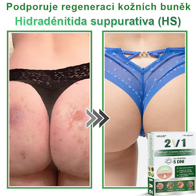 HAJUEI® 💖 𝟐𝐯𝟏 𝐡𝐲𝐝𝐫𝐨𝐤𝐨𝐥𝐨𝐢𝐝𝐧í 𝐧á𝐩𝐥𝐚𝐬𝐭𝐢 𝐬 𝐦𝐢𝐤𝐫𝐨𝐣𝐞𝐡𝐥𝐢č𝐤𝐚𝐦𝐢 | 𝐒𝐩𝐞𝐜𝐢á𝐥𝐧ě 𝐯𝐲𝐯𝐢𝐧𝐮𝐭é 𝐩𝐫𝐨 𝐨𝐝𝐬𝐭𝐫𝐚𝐧ě𝐧í 𝐯𝐲𝐬𝐭𝐨𝐮𝐩𝐥ý𝐜𝐡 𝐦𝐚𝐭𝐞ř𝐬𝐤ý𝐜𝐡 𝐳𝐧𝐚𝐦é𝐧𝐞𝐤, 𝐚𝐤𝐧é, 𝐩𝐥𝐨𝐜𝐡ý𝐜𝐡 𝐛𝐫𝐚𝐝𝐚𝐯𝐢𝐜 𝐚 𝐤𝐨ž𝐧í𝐜𝐡 𝐯ý𝐫ů𝐬𝐭𝐤ů | 𝐁𝐚𝐥𝐞𝐧í 𝟏𝟒𝟒 𝐤𝐮𝐬ů🌵🌵