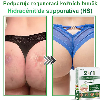 HAJUEI® 💖 𝟐𝐯𝟏 𝐡𝐲𝐝𝐫𝐨𝐤𝐨𝐥𝐨𝐢𝐝𝐧í 𝐧á𝐩𝐥𝐚𝐬𝐭𝐢 𝐬 𝐦𝐢𝐤𝐫𝐨𝐣𝐞𝐡𝐥𝐢č𝐤𝐚𝐦𝐢 | 𝐒𝐩𝐞𝐜𝐢á𝐥𝐧ě 𝐯𝐲𝐯𝐢𝐧𝐮𝐭é 𝐩𝐫𝐨 𝐨𝐝𝐬𝐭𝐫𝐚𝐧ě𝐧í 𝐯𝐲𝐬𝐭𝐨𝐮𝐩𝐥ý𝐜𝐡 𝐦𝐚𝐭𝐞ř𝐬𝐤ý𝐜𝐡 𝐳𝐧𝐚𝐦é𝐧𝐞𝐤, 𝐚𝐤𝐧é, 𝐩𝐥𝐨𝐜𝐡ý𝐜𝐡 𝐛𝐫𝐚𝐝𝐚𝐯𝐢𝐜 𝐚 𝐤𝐨ž𝐧í𝐜𝐡 𝐯ý𝐫ů𝐬𝐭𝐤ů | 𝐁𝐚𝐥𝐞𝐧í 𝟏𝟒𝟒 𝐤𝐮𝐬ů🌵🌵
