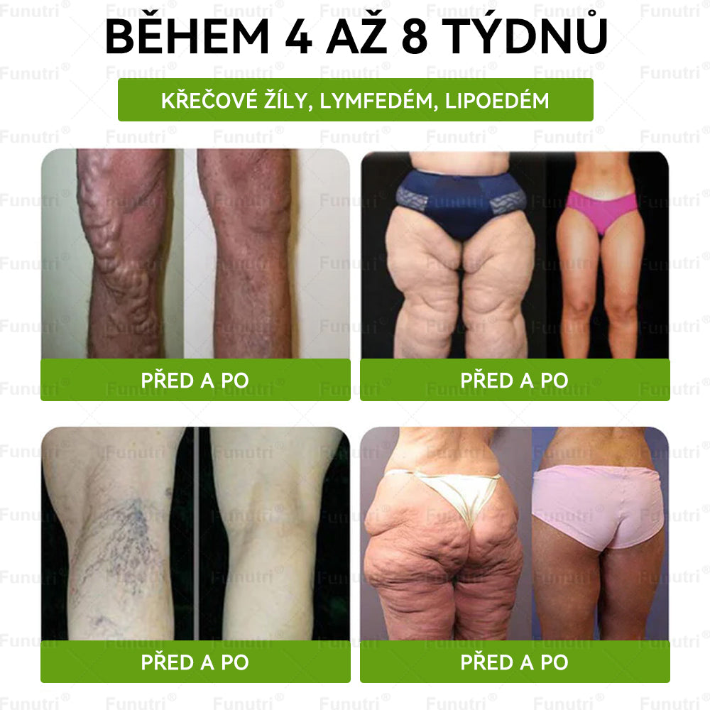 Oficiální obchod 🌿❤️Funutri® 10 v 1 metabolická tvarující náplast s nano mikrojehličkami (Pouze jednou denně, viditelné změny již za 7 dní)  Určeno pro osoby s obezitou, diabetem, spánkovou apnoe