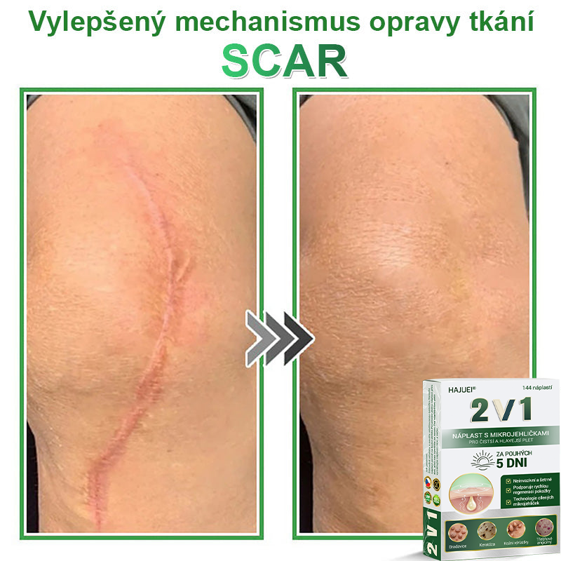 HAJUEI® 💖 𝟐𝐯𝟏 𝐡𝐲𝐝𝐫𝐨𝐤𝐨𝐥𝐨𝐢𝐝𝐧í 𝐧á𝐩𝐥𝐚𝐬𝐭𝐢 𝐬 𝐦𝐢𝐤𝐫𝐨𝐣𝐞𝐡𝐥𝐢č𝐤𝐚𝐦𝐢 | 𝐒𝐩𝐞𝐜𝐢á𝐥𝐧ě 𝐯𝐲𝐯𝐢𝐧𝐮𝐭é 𝐩𝐫𝐨 𝐨𝐝𝐬𝐭𝐫𝐚𝐧ě𝐧í 𝐯𝐲𝐬𝐭𝐨𝐮𝐩𝐥ý𝐜𝐡 𝐦𝐚𝐭𝐞ř𝐬𝐤ý𝐜𝐡 𝐳𝐧𝐚𝐦é𝐧𝐞𝐤, 𝐚𝐤𝐧é, 𝐩𝐥𝐨𝐜𝐡ý𝐜𝐡 𝐛𝐫𝐚𝐝𝐚𝐯𝐢𝐜 𝐚 𝐤𝐨ž𝐧í𝐜𝐡 𝐯ý𝐫ů𝐬𝐭𝐤ů | 𝐁𝐚𝐥𝐞𝐧í 𝟏𝟒𝟒 𝐤𝐮𝐬ů🌵🌵