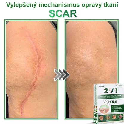 HAJUEI® 💖 𝟐𝐯𝟏 𝐡𝐲𝐝𝐫𝐨𝐤𝐨𝐥𝐨𝐢𝐝𝐧í 𝐧á𝐩𝐥𝐚𝐬𝐭𝐢 𝐬 𝐦𝐢𝐤𝐫𝐨𝐣𝐞𝐡𝐥𝐢č𝐤𝐚𝐦𝐢 | 𝐒𝐩𝐞𝐜𝐢á𝐥𝐧ě 𝐯𝐲𝐯𝐢𝐧𝐮𝐭é 𝐩𝐫𝐨 𝐨𝐝𝐬𝐭𝐫𝐚𝐧ě𝐧í 𝐯𝐲𝐬𝐭𝐨𝐮𝐩𝐥ý𝐜𝐡 𝐦𝐚𝐭𝐞ř𝐬𝐤ý𝐜𝐡 𝐳𝐧𝐚𝐦é𝐧𝐞𝐤, 𝐚𝐤𝐧é, 𝐩𝐥𝐨𝐜𝐡ý𝐜𝐡 𝐛𝐫𝐚𝐝𝐚𝐯𝐢𝐜 𝐚 𝐤𝐨ž𝐧í𝐜𝐡 𝐯ý𝐫ů𝐬𝐭𝐤ů | 𝐁𝐚𝐥𝐞𝐧í 𝟏𝟒𝟒 𝐤𝐮𝐬ů🌵🌵