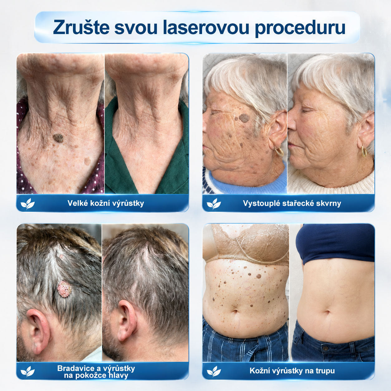 Oficiální značkový obchod | 💚Hiskin® 7denní odstraňovač skvrn a pigmentových skvrn (Bezbolestný rollerball bez jizev)🐬