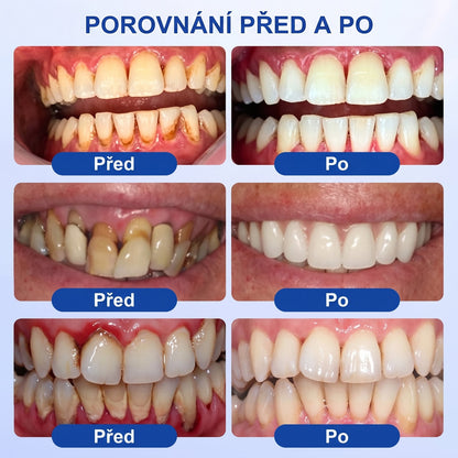💖PureShade® 🦷 GumRevive regenerační gel na dásně – pro zdravější dásně a sebevědomější úsměv 👍