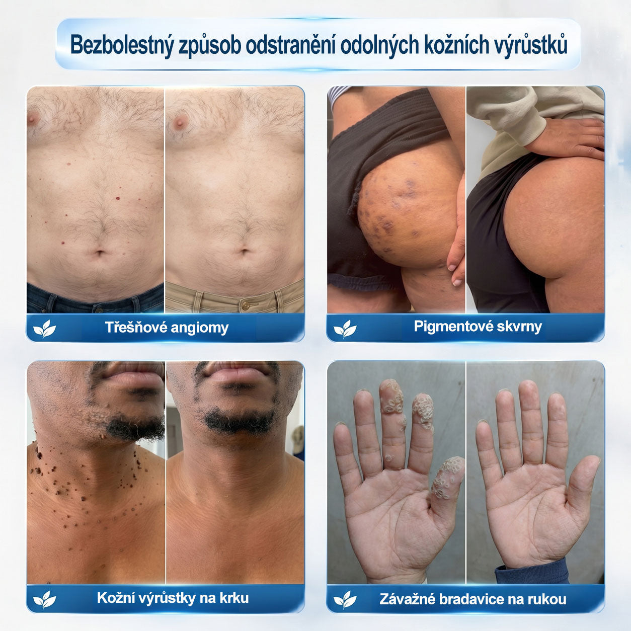 Oficiální značkový obchod | 💚Hiskin® 7denní odstraňovač skvrn a pigmentových skvrn (Bezbolestný rollerball bez jizev)🐬