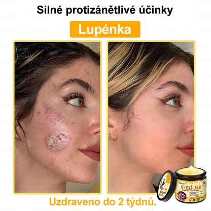 Dermatologicky a klinicky testováno👩‍⚕️🎁APKAPK®Bee Venom Krém na obnovení pleti🐝 pomáhá při léčbě kožních problémů, jako jsou: vrásky, jizvy, pigmentové skvrny, strie, akné, psoriáza, ekzém, kožní změny, podráždění, záněty a další kožní problémy.