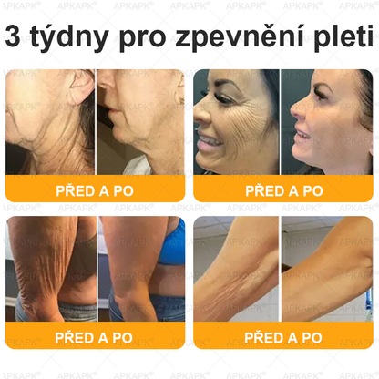 𝖠𝖯𝖪𝖠𝖯𝖪® 🐝~❤️ Krém s včelím jedem na obnovu pokožky 🐝 pomáhá při řešení kožních problémů, jako jsou: vrásky, jizvy, pigmentové skvrny, strie, akné, lupénka, ekzém, kožní léze, podráždění, záněty a další kožní potíže.