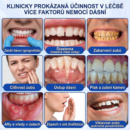 💖PureShade® 🦷 GumRevive regenerační gel na dásně – pro zdravější dásně a sebevědomější úsměv 👍