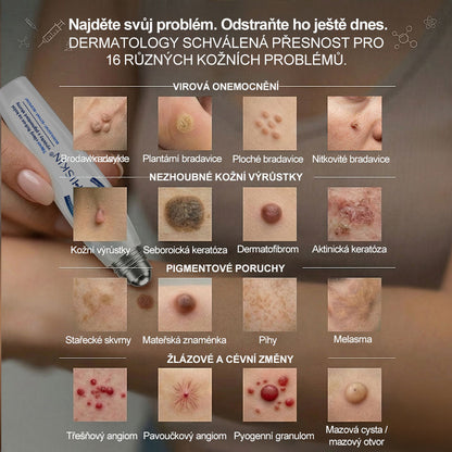 Oficiální značkový obchod | 💚Hiskin® 7denní odstraňovač skvrn a pigmentových skvrn (Bezbolestný rollerball bez jizev)🐬