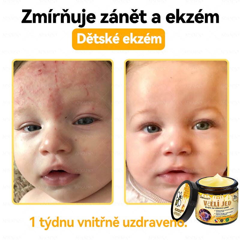 Dermatologicky a klinicky testováno👩‍⚕️🎁APKAPK®Bee Venom Krém na obnovení pleti🐝 pomáhá při léčbě kožních problémů, jako jsou: vrásky, jizvy, pigmentové skvrny, strie, akné, psoriáza, ekzém, kožní změny, podráždění, záněty a další kožní problémy.