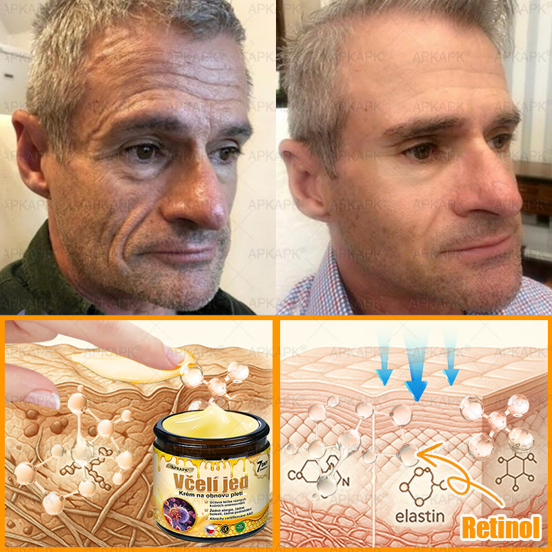 𝖠𝖯𝖪𝖠𝖯𝖪® 🐝~❤️ Krém s včelím jedem na obnovu pokožky 🐝 pomáhá při řešení kožních problémů, jako jsou: vrásky, jizvy, pigmentové skvrny, strie, akné, lupénka, ekzém, kožní léze, podráždění, záněty a další kožní potíže.