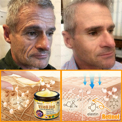 𝖠𝖯𝖪𝖠𝖯𝖪® 🐝~❤️ Krém s včelím jedem na obnovu pokožky 🐝 pomáhá při řešení kožních problémů, jako jsou: vrásky, jizvy, pigmentové skvrny, strie, akné, lupénka, ekzém, kožní léze, podráždění, záněty a další kožní potíže.