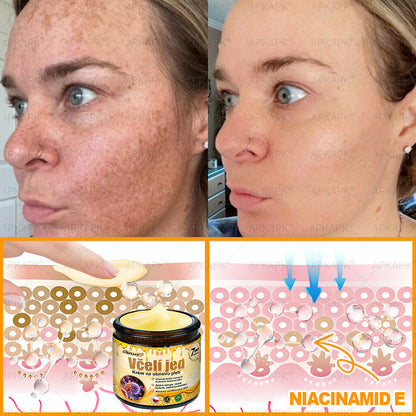 𝖠𝖯𝖪𝖠𝖯𝖪® 🐝~❤️ Krém s včelím jedem na obnovu pokožky 🐝 pomáhá při řešení kožních problémů, jako jsou: vrásky, jizvy, pigmentové skvrny, strie, akné, lupénka, ekzém, kožní léze, podráždění, záněty a další kožní potíže.