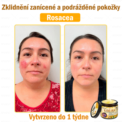 Dermatologicky a klinicky testováno👩‍⚕️🎁APKAPK®Bee Venom Krém na obnovení pleti🐝 pomáhá při léčbě kožních problémů, jako jsou: vrásky, jizvy, pigmentové skvrny, strie, akné, psoriáza, ekzém, kožní změny, podráždění, záněty a další kožní problémy.