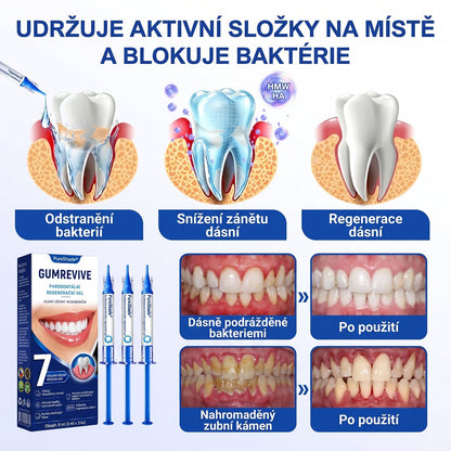 💖PureShade® 🦷 GumRevive regenerační gel na dásně – pro zdravější dásně a sebevědomější úsměv 👍