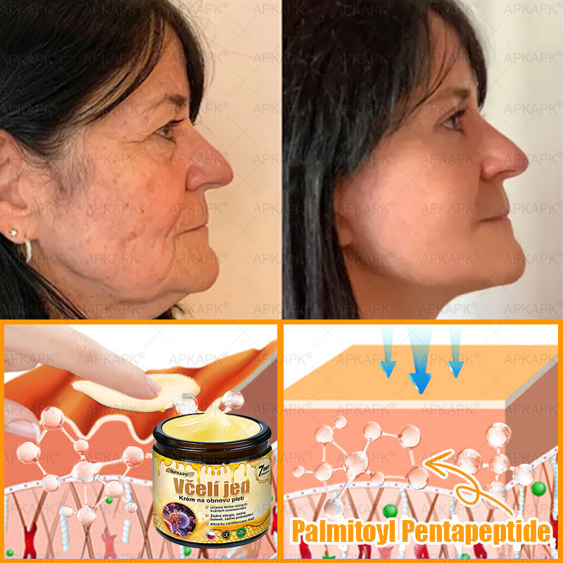 𝖠𝖯𝖪𝖠𝖯𝖪® 🐝~❤️ Krém s včelím jedem na obnovu pokožky 🐝 pomáhá při řešení kožních problémů, jako jsou: vrásky, jizvy, pigmentové skvrny, strie, akné, lupénka, ekzém, kožní léze, podráždění, záněty a další kožní potíže.