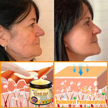 𝖠𝖯𝖪𝖠𝖯𝖪® 🐝~❤️ Krém s včelím jedem na obnovu pokožky 🐝 pomáhá při řešení kožních problémů, jako jsou: vrásky, jizvy, pigmentové skvrny, strie, akné, lupénka, ekzém, kožní léze, podráždění, záněty a další kožní potíže.
