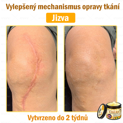Dermatologicky a klinicky testováno👩‍⚕️🎁APKAPK®Bee Venom Krém na obnovení pleti🐝 pomáhá při léčbě kožních problémů, jako jsou: vrásky, jizvy, pigmentové skvrny, strie, akné, psoriáza, ekzém, kožní změny, podráždění, záněty a další kožní problémy.