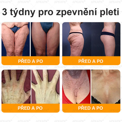 𝖠𝖯𝖪𝖠𝖯𝖪® 🐝~❤️ Krém s včelím jedem na obnovu pokožky 🐝 pomáhá při řešení kožních problémů, jako jsou: vrásky, jizvy, pigmentové skvrny, strie, akné, lupénka, ekzém, kožní léze, podráždění, záněty a další kožní potíže.