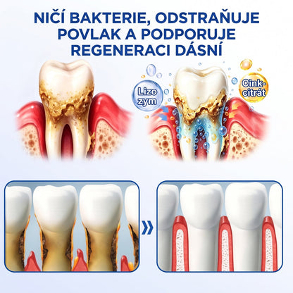 💖PureShade® 🦷 GumRevive regenerační gel na dásně – pro zdravější dásně a sebevědomější úsměv 👍