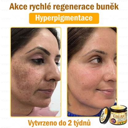 Dermatologicky a klinicky testováno👩‍⚕️🎁APKAPK®Bee Venom Krém na obnovení pleti🐝 pomáhá při léčbě kožních problémů, jako jsou: vrásky, jizvy, pigmentové skvrny, strie, akné, psoriáza, ekzém, kožní změny, podráždění, záněty a další kožní problémy.