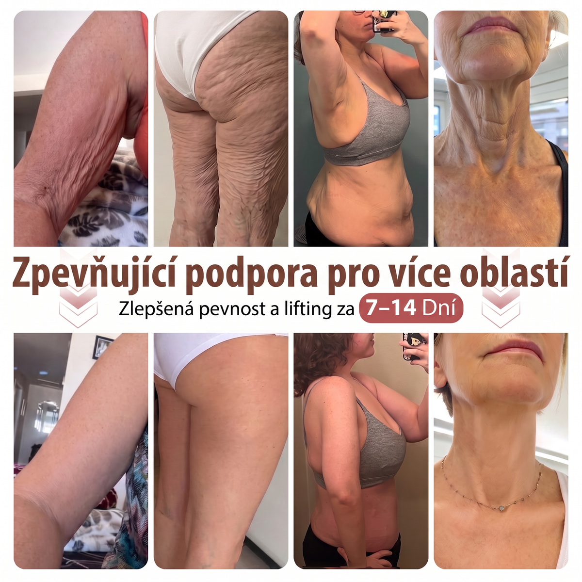 💯HISKIN® Mikroneedlová náplast pro podporu objemu, lifting a pevnost prsou