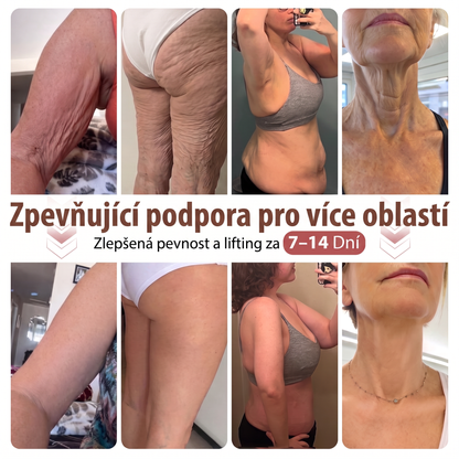 💯HISKIN® Mikroneedlová náplast pro podporu objemu, lifting a pevnost prsou