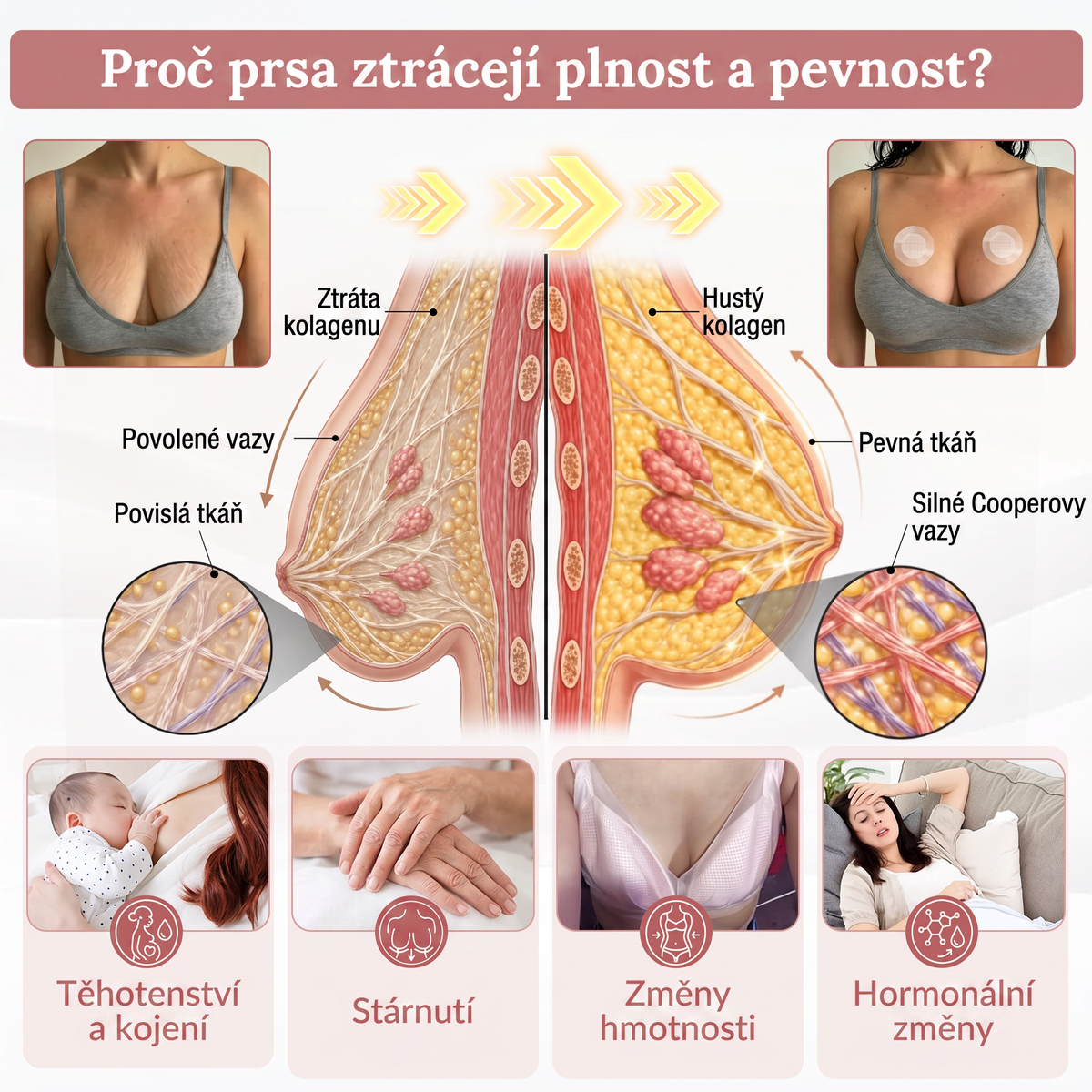 💯HISKIN® Mikroneedlová náplast pro podporu objemu, lifting a pevnost prsou