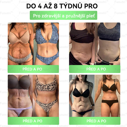 Oficiální obchod 🌿❤️Funutri® 10 v 1 metabolická tvarující náplast s nano mikrojehličkami (Pouze jednou denně, viditelné změny již za 7 dní)  Určeno pro osoby s obezitou, diabetem, spánkovou apnoe